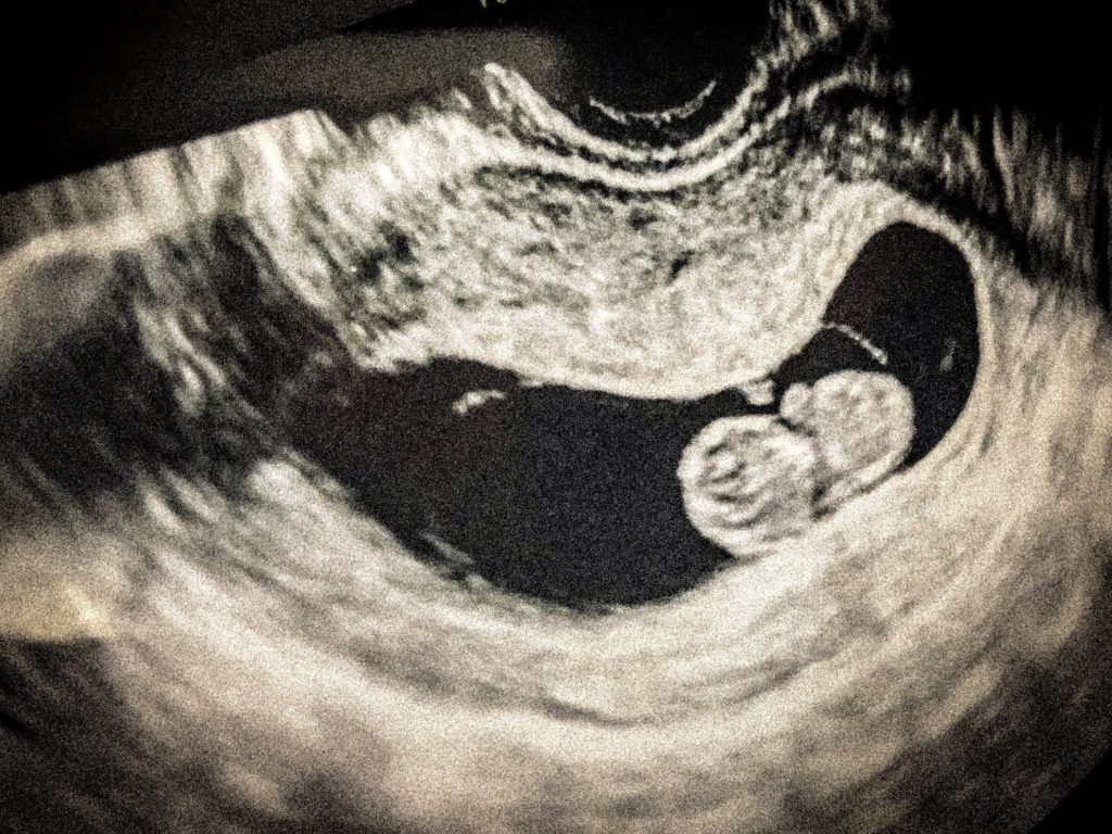 Pregnancy in Japan The First Trimester, Commuting, and Choosing a Clinic